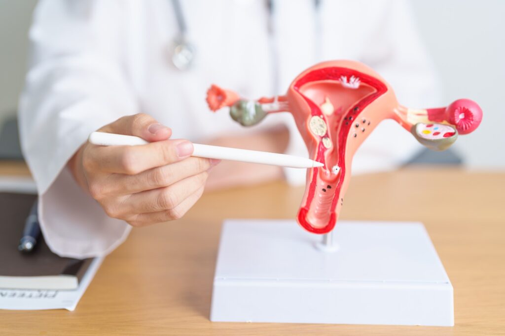 Endometriosis and Pregnancy