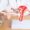 Endometriosis and Pregnancy
