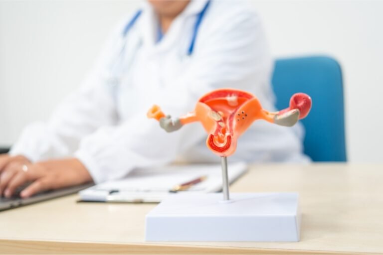 Fibroids in Women