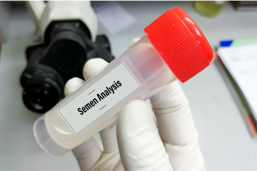 Poor Semen Report