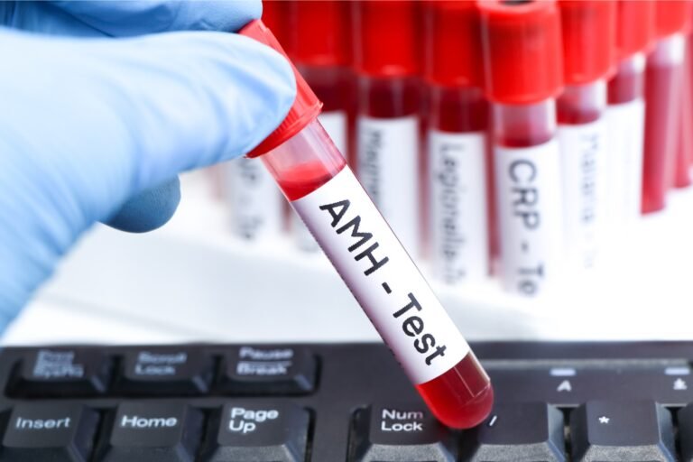 AMH Levels