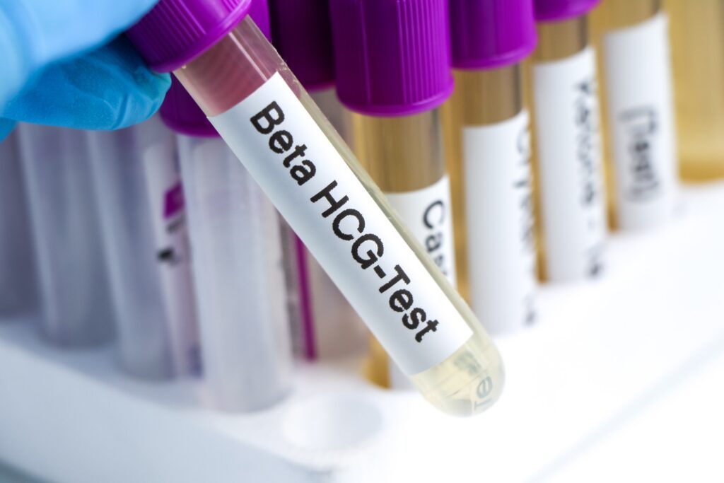 Beta-hCG