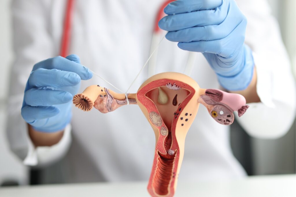 Blocked Fallopian Tube