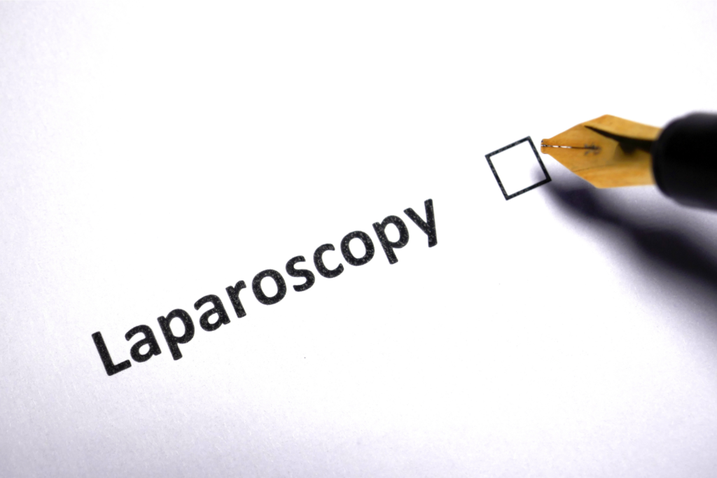 Laparoscopy