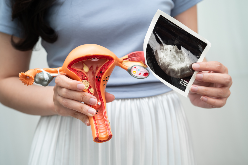 Uterus Abnormalities